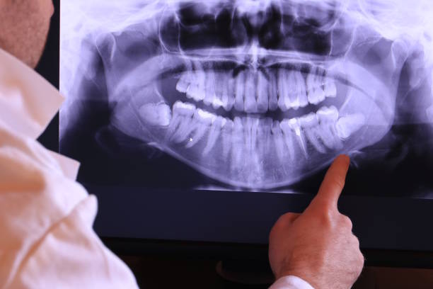 Best Chipped Tooth Repair Near Me  in Leith Hatfield, PA